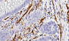 S100-Antikörperreagenz (Immunhistochemie)