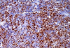 Cyclin D1 Protein ProteinAntikörperreagenz (Immunhistochemie)