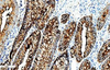 Karzinoembryonales Antigen (CEA)-Antikörperreagenz (Immunhistochemie)