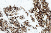 Cytokeratin (Breitspektrum)Antikörperreagenz (Immunhistochemie)